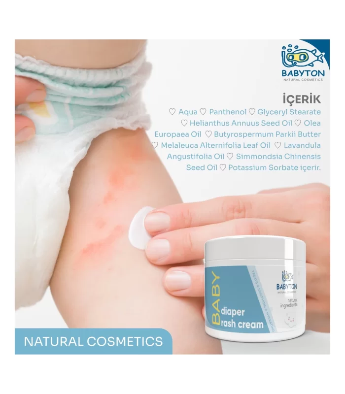 Babyton Pişik Önleyici Krem 50 ml