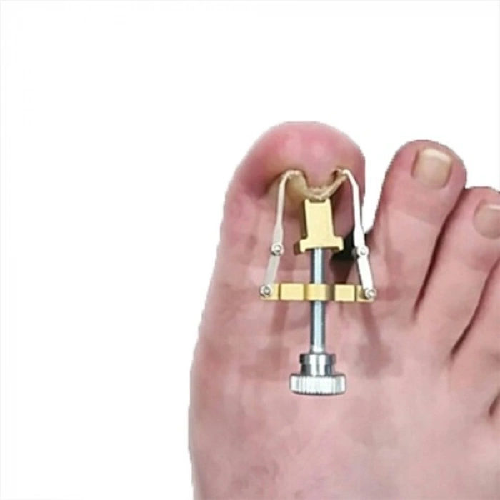 VipMarketim Batık Tırnak Düzeltme Aleti