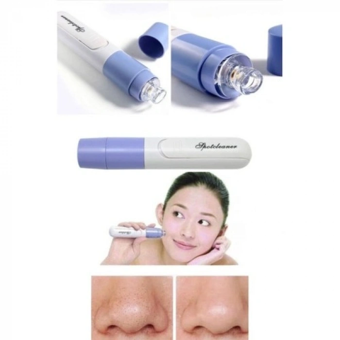 VipMarketim Pore Cleaner Vakumlu Yüz Temizleme Siyah Nokta Temizleme Cihazı