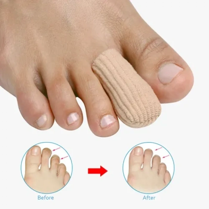 VipMarketim Silikon Kumaş Kaplı Nasır Koruyucu Hortum