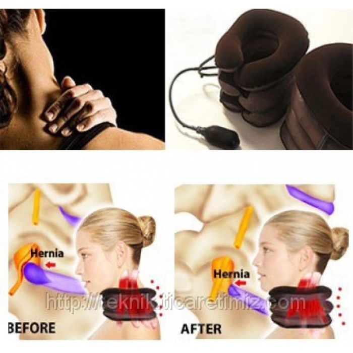 VipMarketim Şişirilebilir Pompalı Ortopedik Boyun ve Seyahat Yastığı