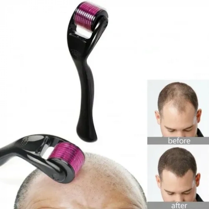 VipMarketim Titanyum Derma Roller 1.00 mm