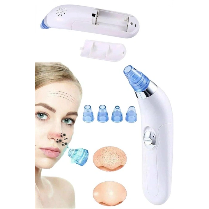 VipMarketim Vakumlu Siyah Nokta Ve Yüz Temizleme Cihazı 4 Başlıklı