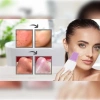 VipMarketim ULTRASONIC SİYAH NOKTA AKNE SPATULA ŞARJLI CİLT TEMİZLEYİCİ
