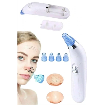 VipMarketim Vakumlu Siyah Nokta Ve Yüz Temizleme Cihazı 4 Başlıklı