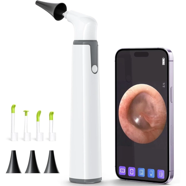 ScopeAround Otoskop, Kulak Kiri Temizleme Aleti ile Birlikte - 3.9 mm