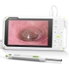 Anykit Dijital Otoskop, Jiroskop, 4 Inc IPS Ekran, HD Kulak Kamerası - 3.9mm