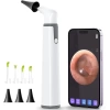 ScopeAround Otoskop, Kulak Kiri Temizleme Aleti ile Birlikte - 3.9 mm