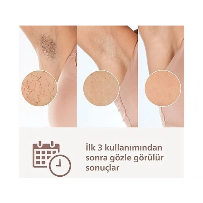 PHILIPS Lumea BRI951/03 IPL Epilasyon Cihazı