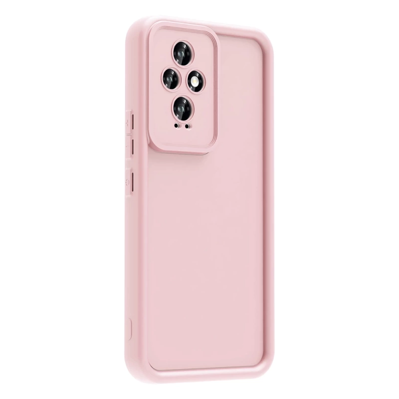 Honor 200 Kılıf Kamera Korumalı Zore Ananas Kapak