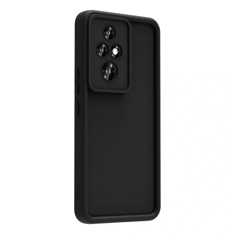 Honor 200 Pro Kılıf Kamera Korumalı Zore Ananas Kapak