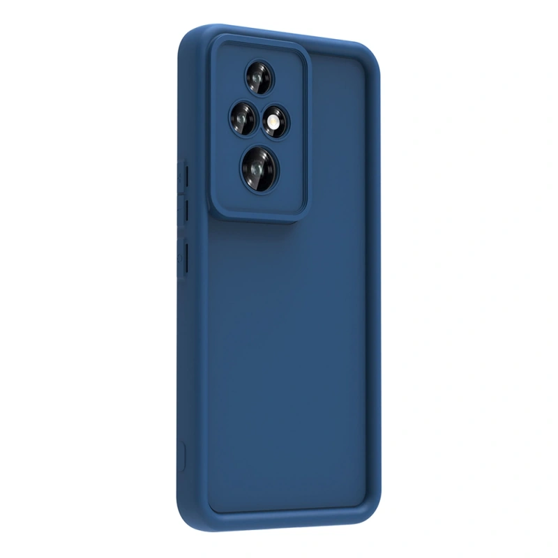Honor 200 Pro Kılıf Kamera Korumalı Zore Ananas Kapak