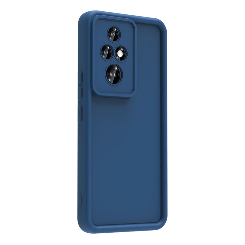 Honor 200 Pro Kılıf Kamera Korumalı Zore Ananas Kapak