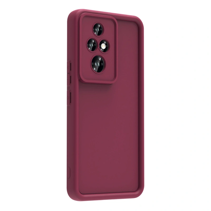Honor 200 Pro Kılıf Kamera Korumalı Zore Ananas Kapak