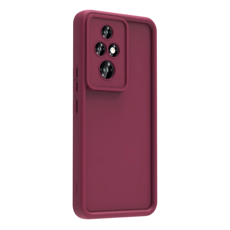 Honor 200 Pro Kılıf Kamera Korumalı Zore Ananas Kapak