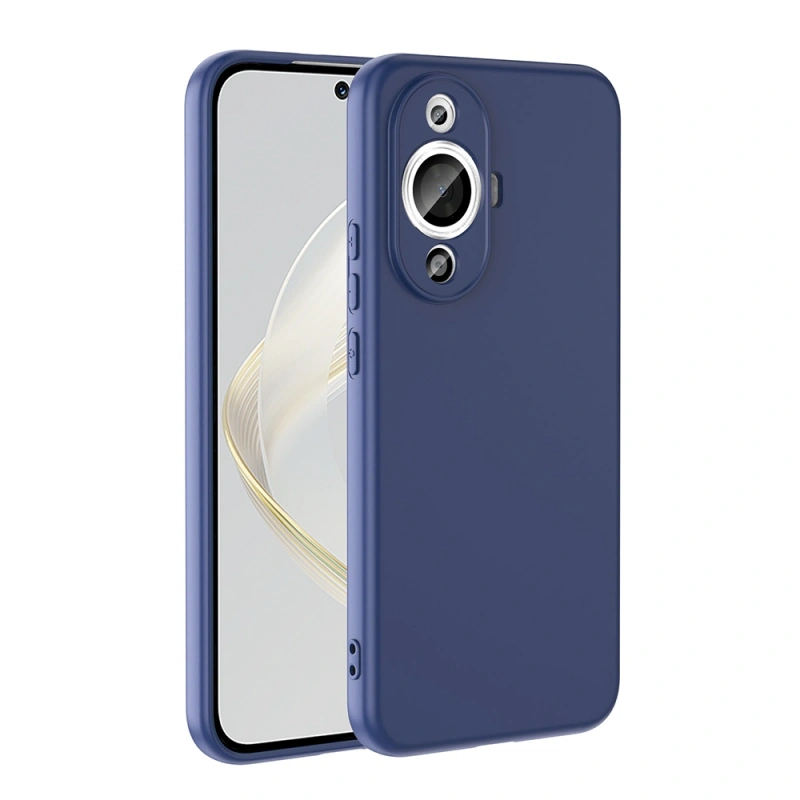 Huawei Nova 12S Kılıf Zore Mara Lansman Kapak
