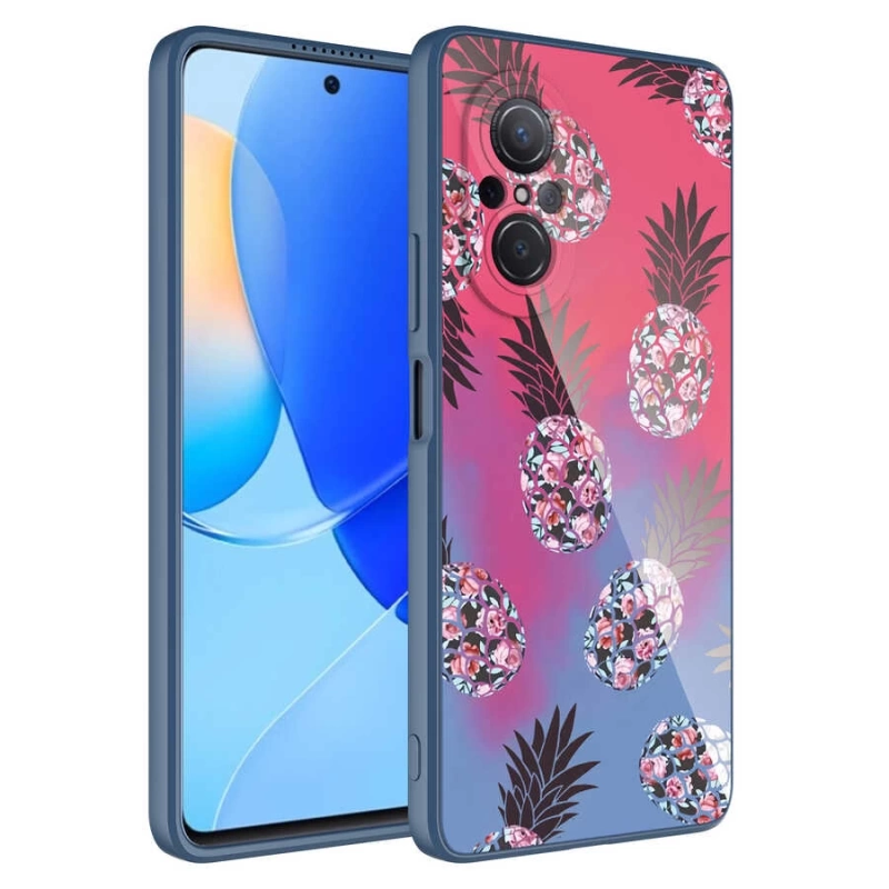 Huawei Nova 9 SE Kılıf Kamera Korumalı Desenli Sert Silikon Zore Epoksi Kapak