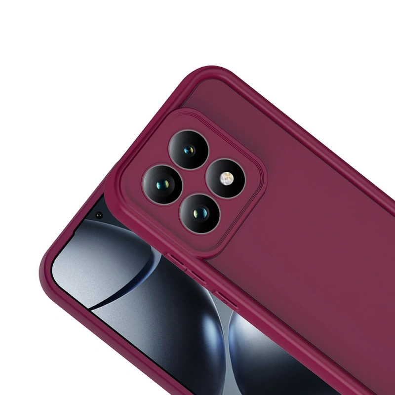 Xiaomi 15T Kılıf Kamera Korumalı Zore Ananas Kapak