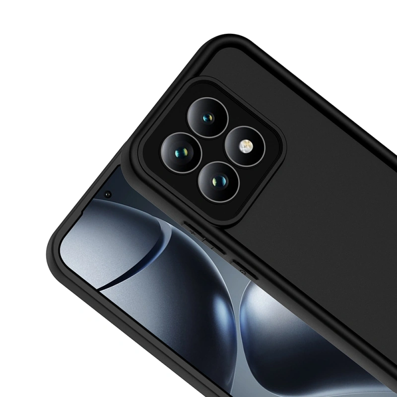 Xiaomi 15T Kılıf Kamera Korumalı Zore Ananas Kapak