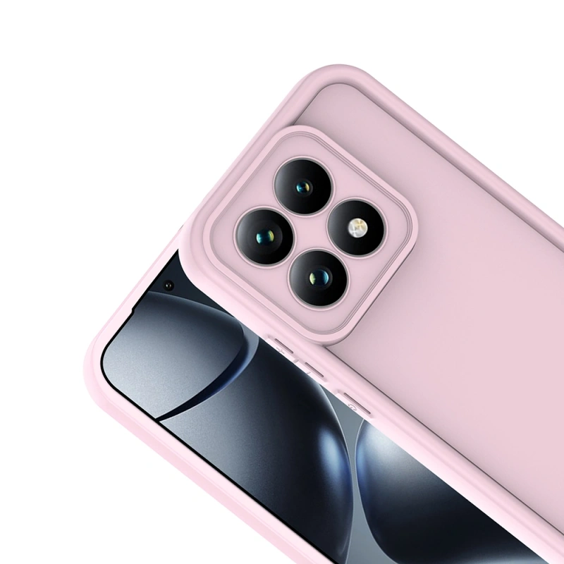 Xiaomi 15T Kılıf Kamera Korumalı Zore Ananas Kapak