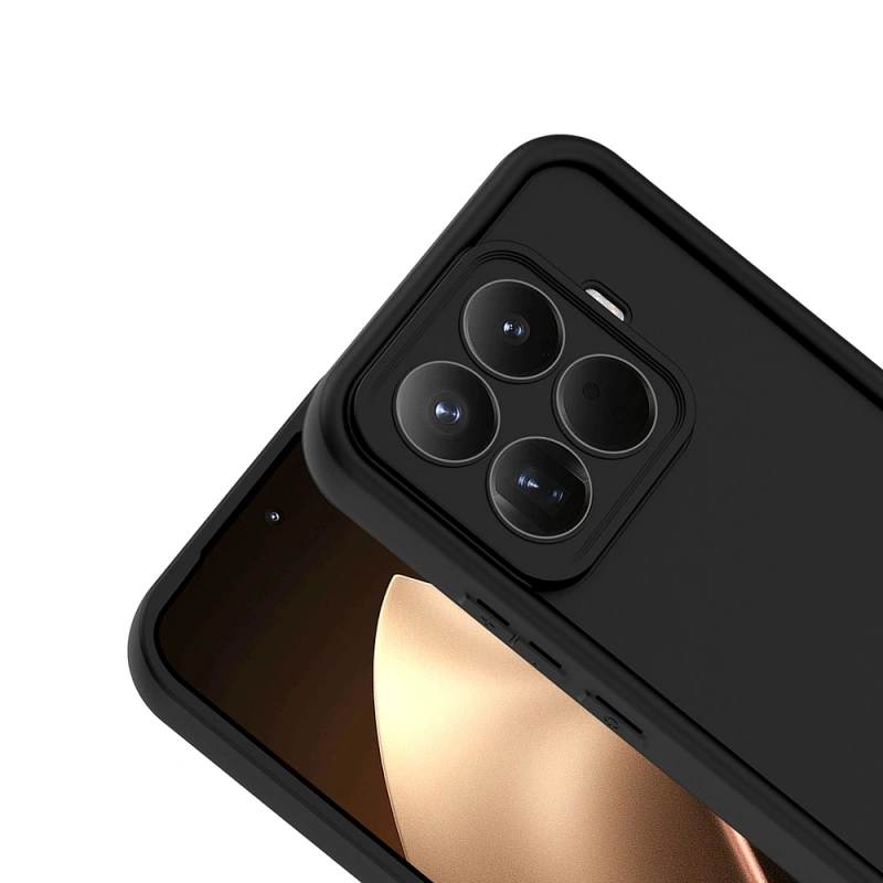 Xiaomi 15T Pro Kılıf Kamera Korumalı Zore Ananas Kapak