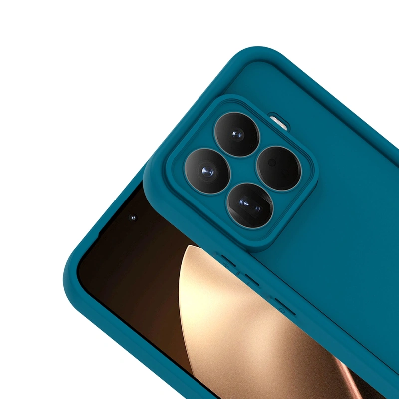 Xiaomi 15T Pro Kılıf Kamera Korumalı Zore Ananas Kapak