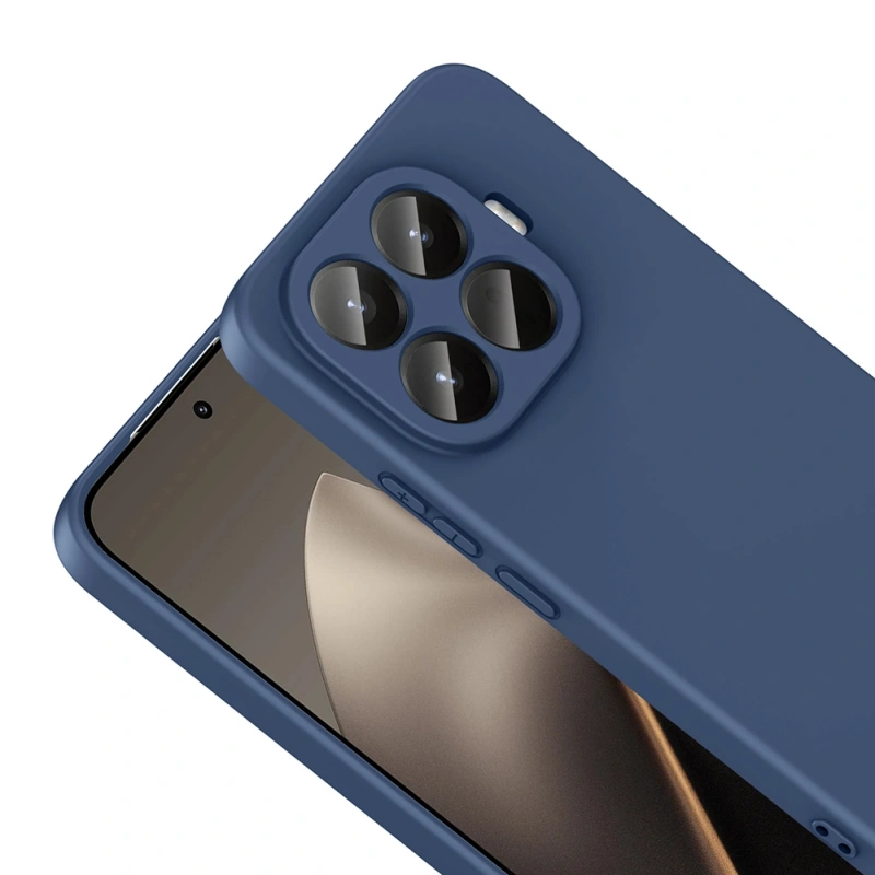 Xiaomi 15T Pro Kılıf Zore Mara Lansman Kapak