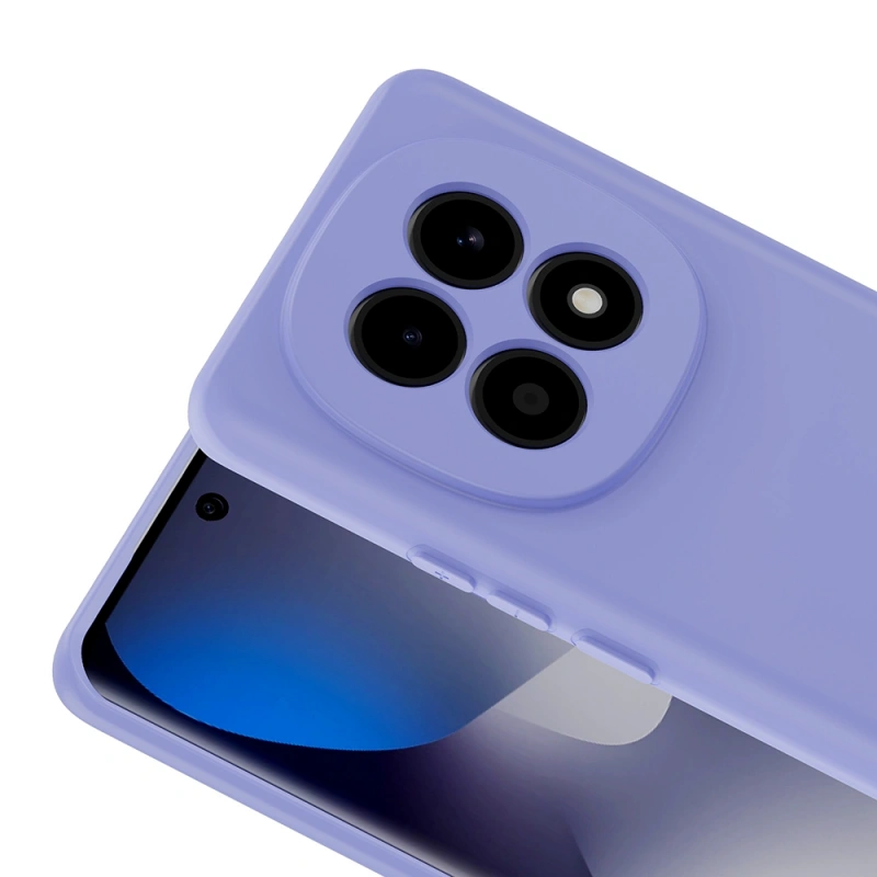 Xiaomi Redmi Note 15 5G Kılıf Zore Mara Lansman Kapak