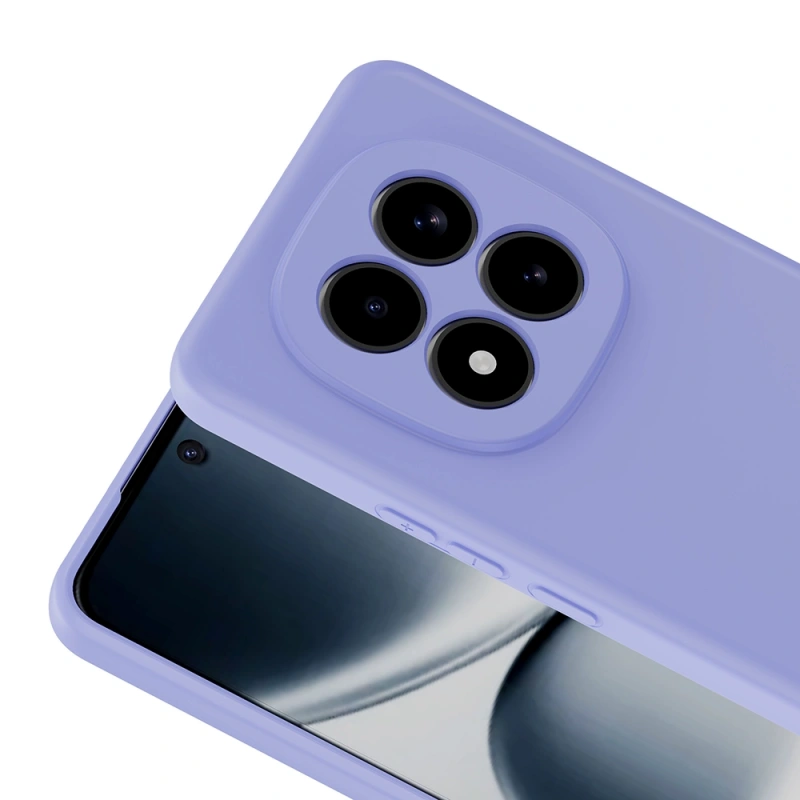 Xiaomi Redmi Note 15 Pro 4G Kılıf Zore Mara Lansman Kapak