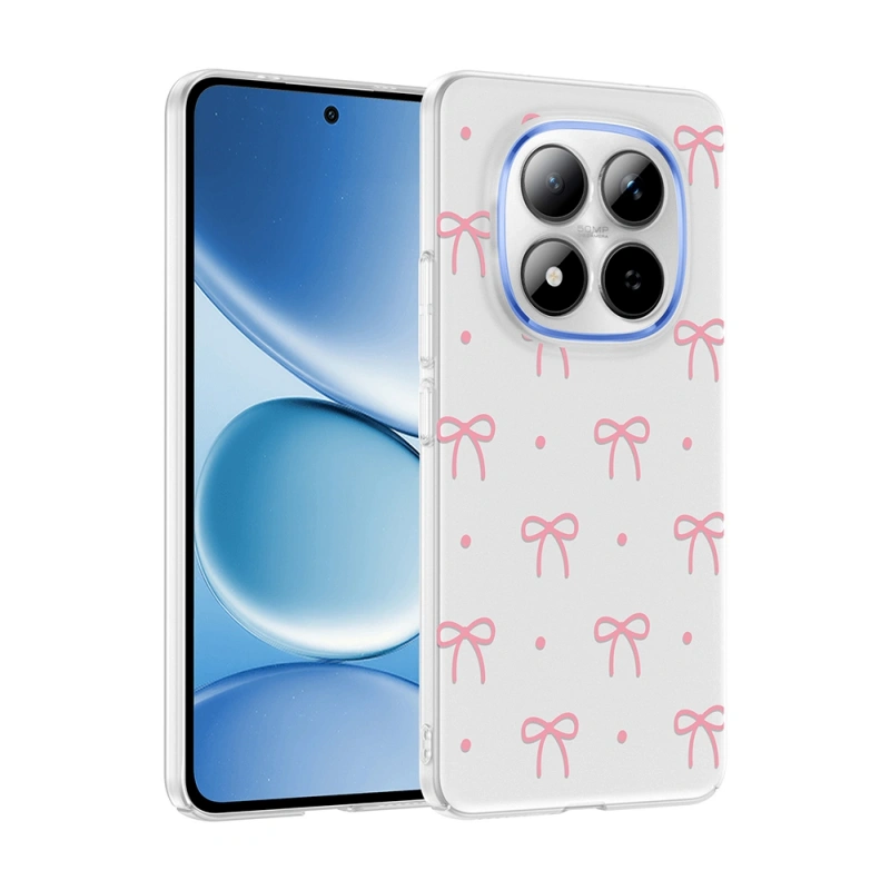 Xiaomi Redmi Note 15 Pro Plus Kılıf Kamera Korumalı Desenli Zore Klip Kapak