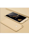 Xiaomi Mi Max 2 Kılıf Zore Ays Kapak