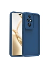 Honor 200 Pro Kılıf Kamera Korumalı Zore Ananas Kapak
