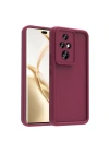 Honor 200 Pro Kılıf Kamera Korumalı Zore Ananas Kapak