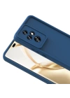 Honor 200 Pro Kılıf Kamera Korumalı Zore Ananas Kapak