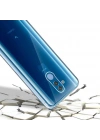 Huawei Mate 20 Lite Kılıf Zore Enjoy Kapak
