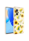 Huawei Nova 9 SE Kılıf Kamera Korumalı Desenli Sert Silikon Zore Epoksi Kapak