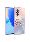 Huawei Nova 9 SE Kılıf Kamera Korumalı Desenli Sert Silikon Zore Epoksi Kapak