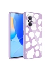 Huawei Nova 9 SE Kılıf Kamera Korumalı Desenli Sert Silikon Zore Epoksi Kapak