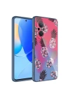 Huawei Nova 9 SE Kılıf Kamera Korumalı Desenli Sert Silikon Zore Epoksi Kapak