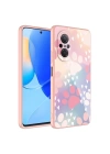 Huawei Nova 9 SE Kılıf Kamera Korumalı Desenli Sert Silikon Zore Epoksi Kapak