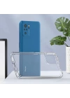 More TR Xiaomi Redmi Note 10 Kılıf Zore Coss Kapak