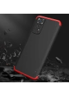 More TR Xiaomi Redmi Note 11S Global Kılıf Zore Ays Kapak