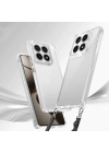 Xiaomi 14T Pro Kılıf Airbagli Takılabilir Askı Aparatlı Zore Snap Silikon Kapak