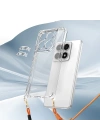Xiaomi 14T Pro Kılıf Airbagli Takılabilir Askı Aparatlı Zore Snap Silikon Kapak