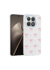 Xiaomi 15T Kılıf Kamera Korumalı Desenli Zore Klip Kapak