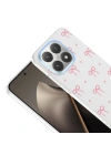 Xiaomi 15T Kılıf Kamera Korumalı Desenli Zore Klip Kapak