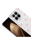 Xiaomi 15T Pro Kılıf Kamera Korumalı Desenli Zore Klip Kapak