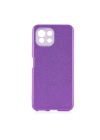 Xiaomi Mi 11 Lite Kılıf Zore Shining Silikon