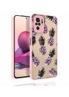 Xiaomi Poco M5S Kılıf Desenli Kamera Korumalı Parlak Zore Nora Kapak