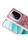 Xiaomi Poco X7 Kılıf Kamera Korumalı Figürlü Zore Ponti Silikon Kapak